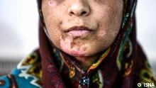 Iran Frau Häusliche Gewalt (ISNA)
