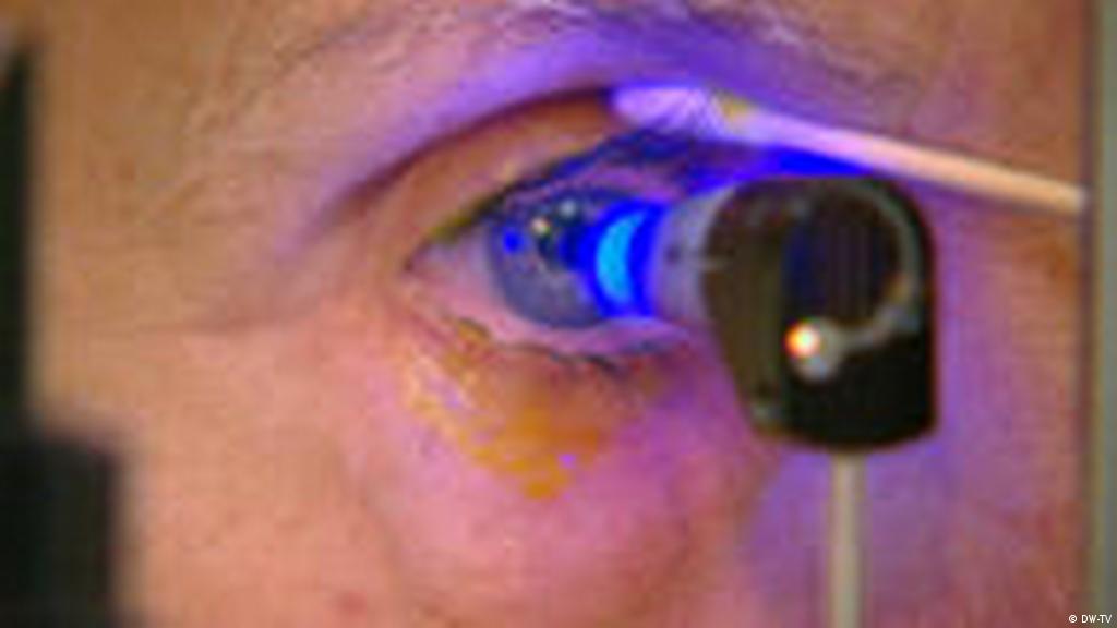 أسباب إصابة العين بمرض الزرق وطرق علاجه علوم وتكنولوجيا آخر